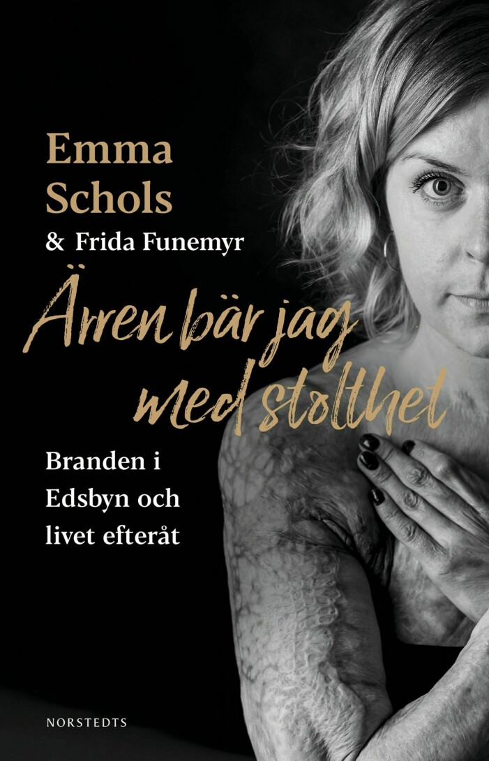 Bokens omslag visar Emma och hennes ärr