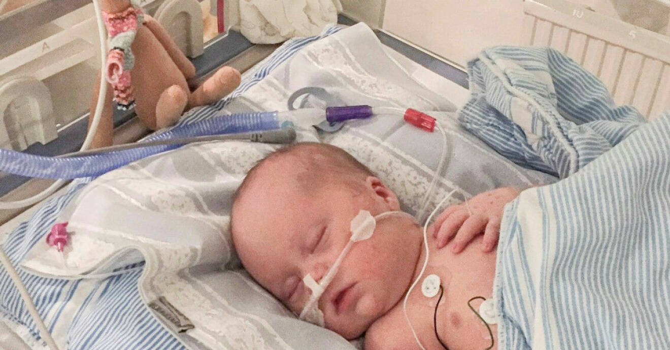 Nyfödde Svante ligger på sjukhuset med slangar i kopplade.