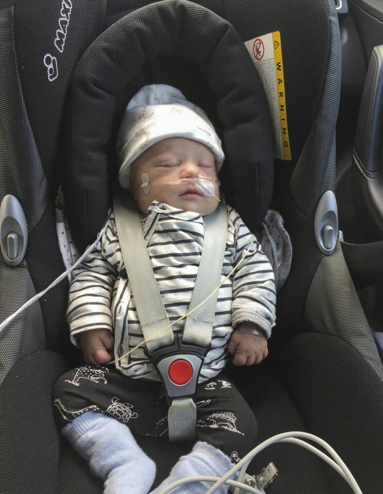 Nyfödde Svante, med Downs syndrom, ligger och sover i en bilbarnstol. Han har på sig en randig tröja och en vit mössa.