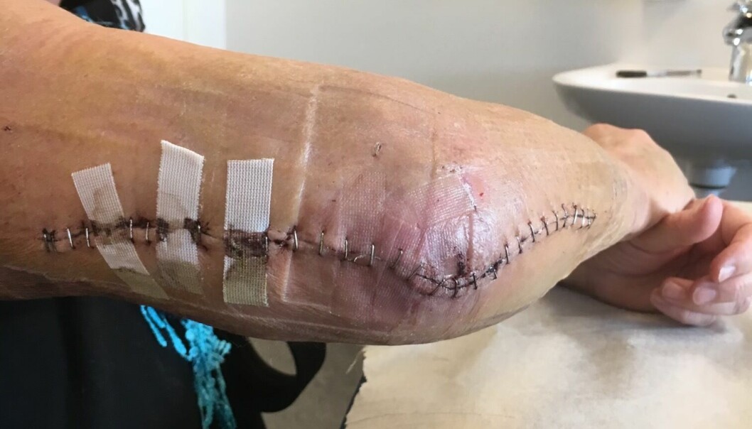 Sjukvården sydde ihop Maritas arm men återställd blir hon inte. Maritas arm krossades i attacken