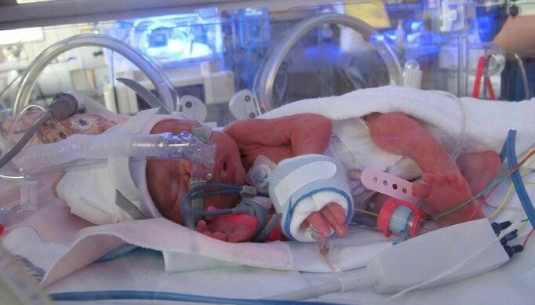 Den första tiden handlade om att hålla Milea vid liv. Prematurbebis på sjukhuset